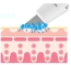 Urządzenie do peelingu kawitacyjnego do twarzy Skin Cleaner bezprzewodowy – zdjęcie 7